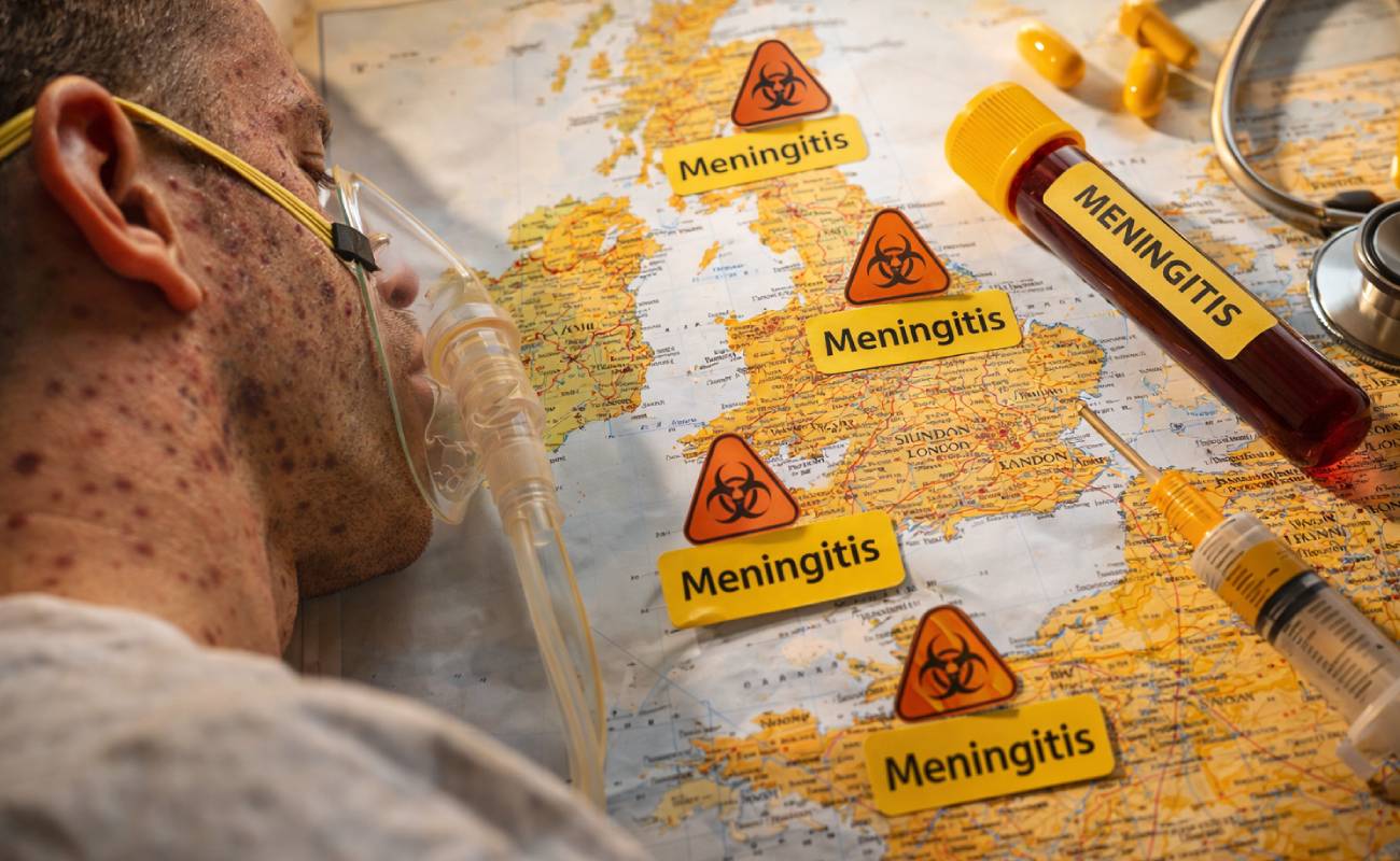 Kent’te menenjit alarmı büyüyor